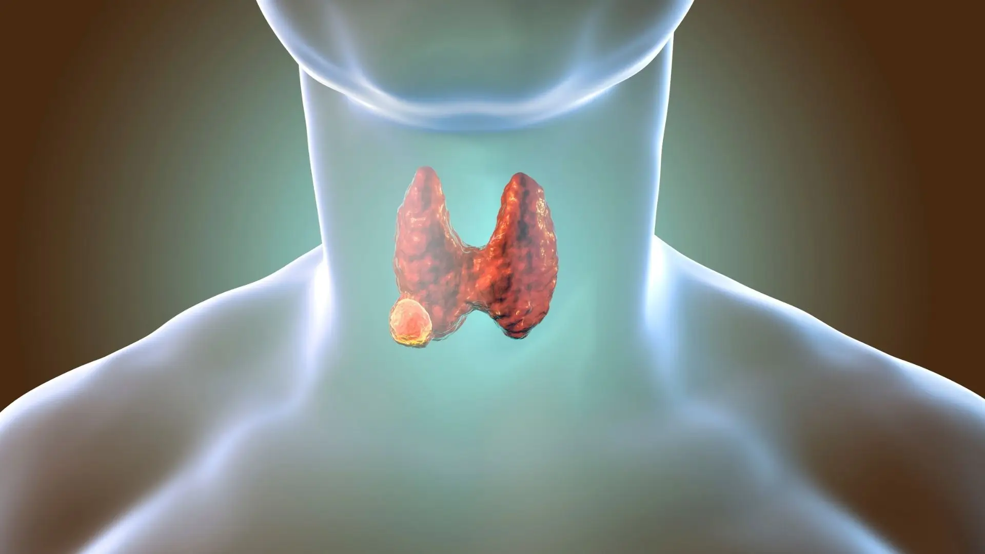 malattie endocrine